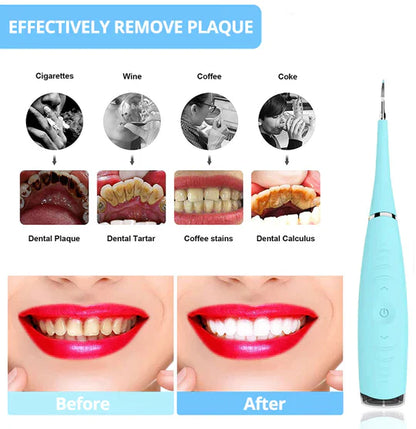 Smile Therapy - Ultrasonic Tooth Cleaner *BEST SELLER* DP8