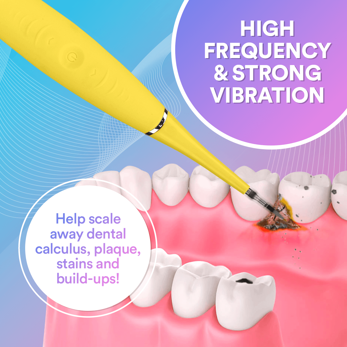 Smile Therapy - Ultrasonic Tooth Cleaner *BEST SELLER* DP8